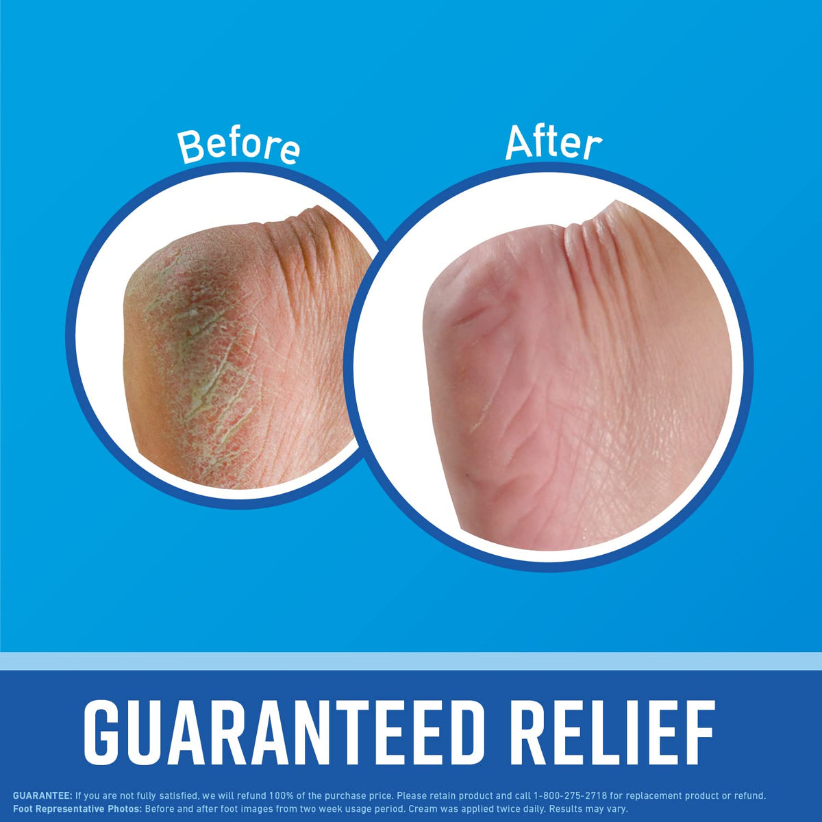 Close-up of O'Keeffe's Healthy Feet tube highlighting concentrated formula.