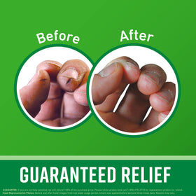 O'Keeffe's Healthy Feet jar close-up emphasizing foot cream for cracked feet.
