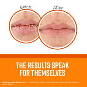 O'Keeffe's Lip Repair Original lip balm tube for easy application