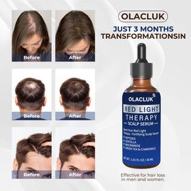 OLACLUK Hydration and comfort for the scalp after red light therapy sessions.
