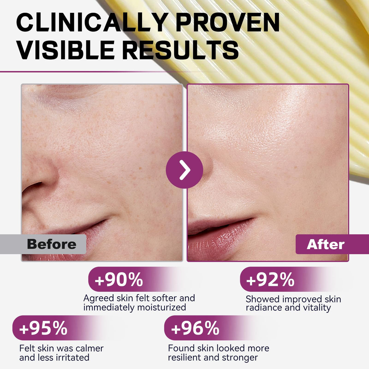 OLELON Helichrysum Balm applied to skin for daily nourishment and comfort.
