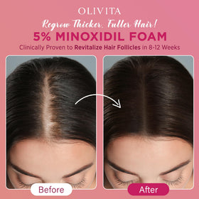 OLIVITA minoxidil foam 5% women fast-drying-texture reduces greasy residue.