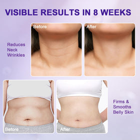 OLV Overnight Toning Whip neck-area gentle firming for decolletage area