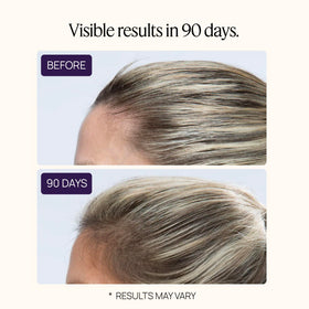 Illustration of follicle boost concept with OMI WellBeauty peptides