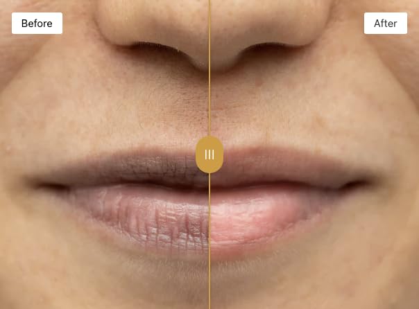 Vitamin E in Omorfee Lip Lightening Scrub nourishes the lips.