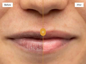 Vitamin E in Omorfee Lip Lightening Scrub nourishes the lips.