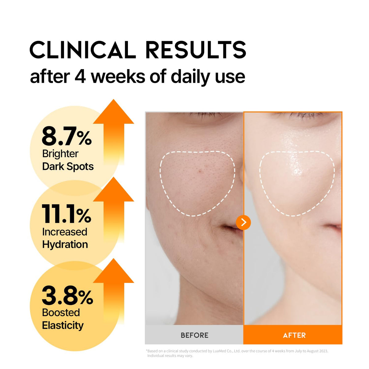 OOTD Vitamin C Serum box packaging open reveals sleek branding