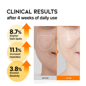 OOTD Vitamin C Serum box packaging open reveals sleek branding