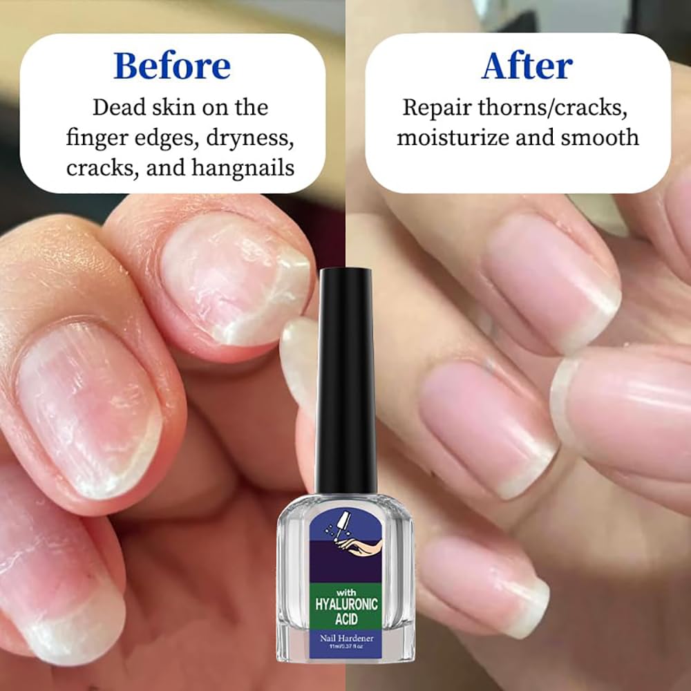 Oprtuisi Cuticle Oil 2-Pack bottle back with packaging and lightweight finish