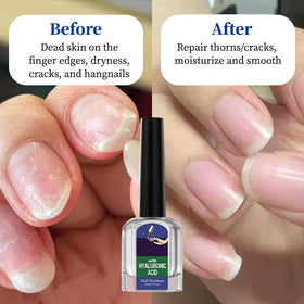 Oprtuisi Cuticle Oil 2-Pack bottle back with packaging and lightweight finish