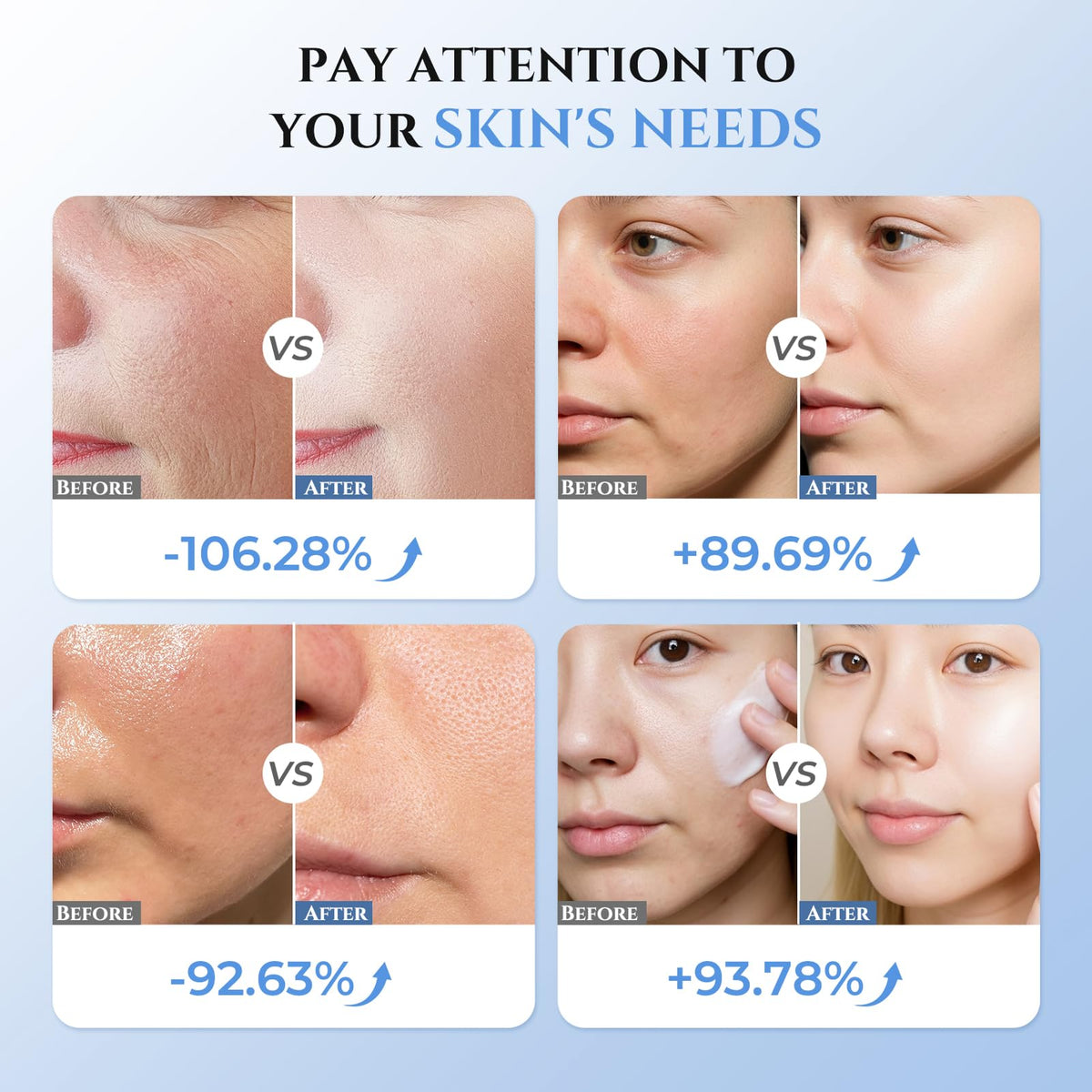 Oranmagic RF skin tightening probe offering flat design for easy cleaning.