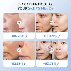 Oranmagic RF skin tightening probe offering flat design for easy cleaning.