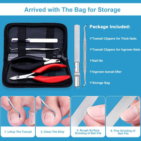 Orelex storage bag included keeps the set organized and gift-ready.