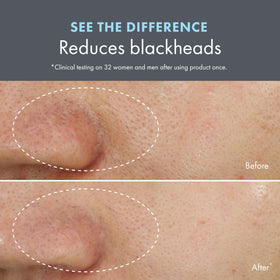 Origins Clear Improvement skin texture appears smoother and pores less noticeable