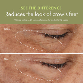 Origins Plantscription before-after visualization suggests smoother under-eye skin