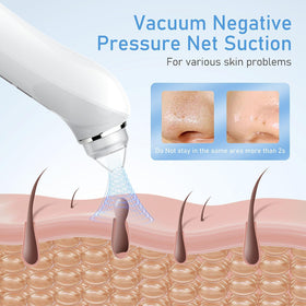 Ottleba 20x zoom view highlights skin texture for targeted extractions