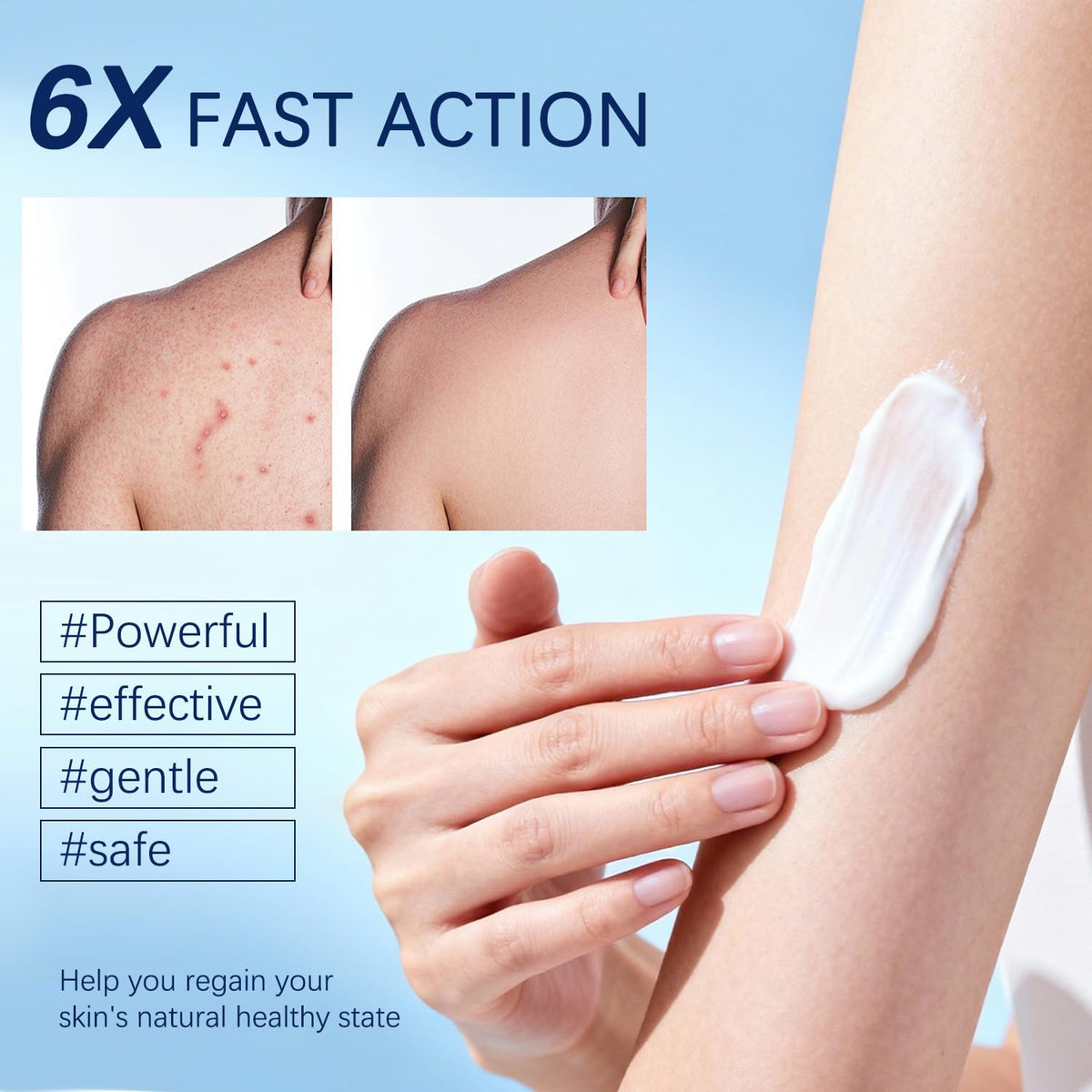 OUHENGTEK Folliculitis Cream applied to the face to calm bumps.