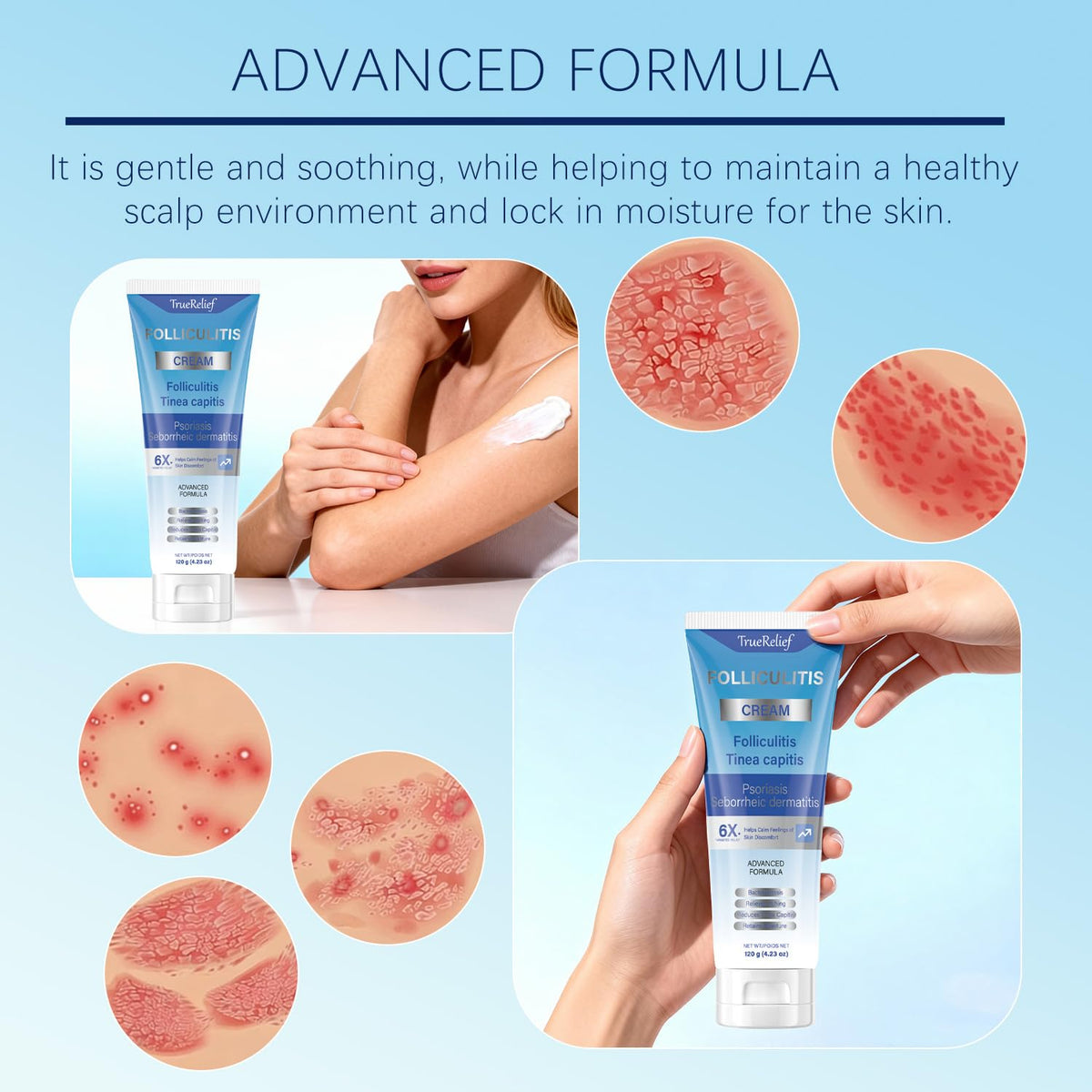 Two-pack packaging of OUHENGTEK Folliculitis Cream ready for daily use.
