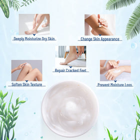 OUKEYA 40% urea cream being applied to a cracked heel, soothing dry skin.