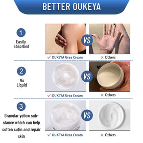 OUKEYA 40% urea cream on hands, nourishing rough skin for daily use.