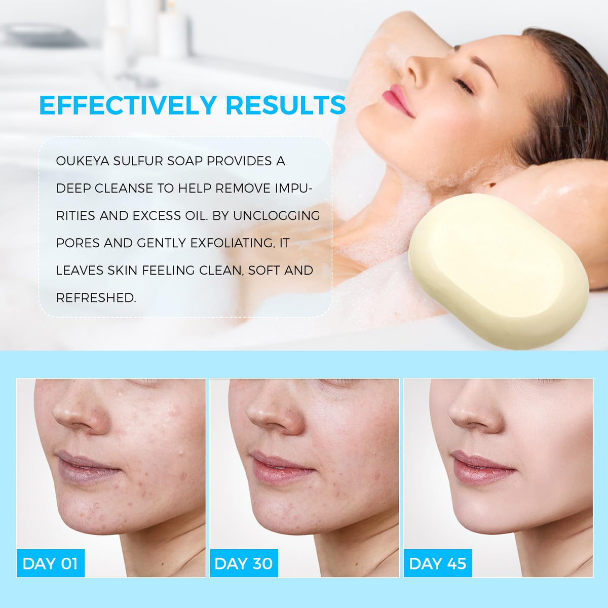 OUKEYA sulfur soap bar lathering on skin with creamy foam.