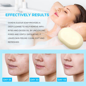 OUKEYA sulfur soap bar lathering on skin with creamy foam.