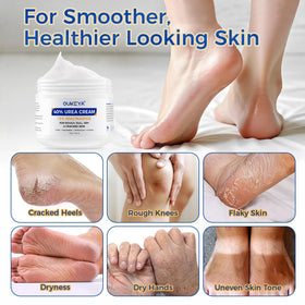 OUKEYA Urea Cream 40% being applied on feet for daily moisture