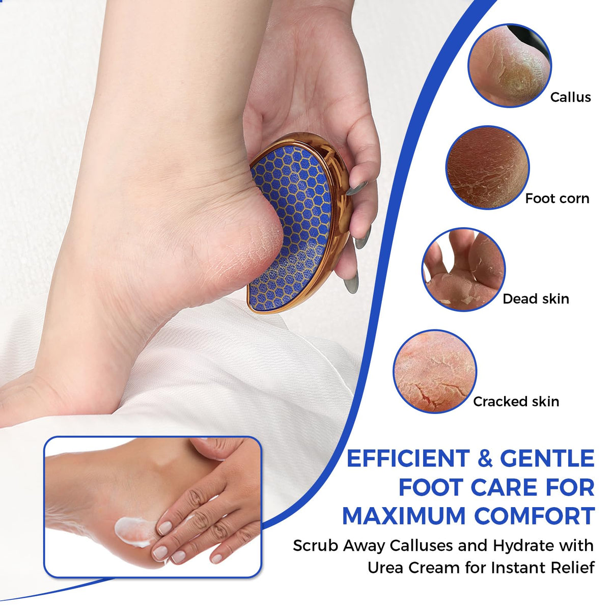 OUKEYA 42% urea cream dry-skin smoothing for elbows and knees