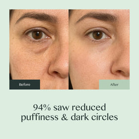 OURAGLOW retinol eye cream targets fine lines and improves elasticity without heaviness.