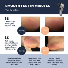 Own Harmony waterproof foot file for use in wet or dry conditions.