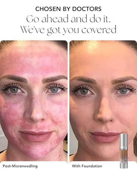 Oxygenetix Ivory foundation applied to face for a natural finish