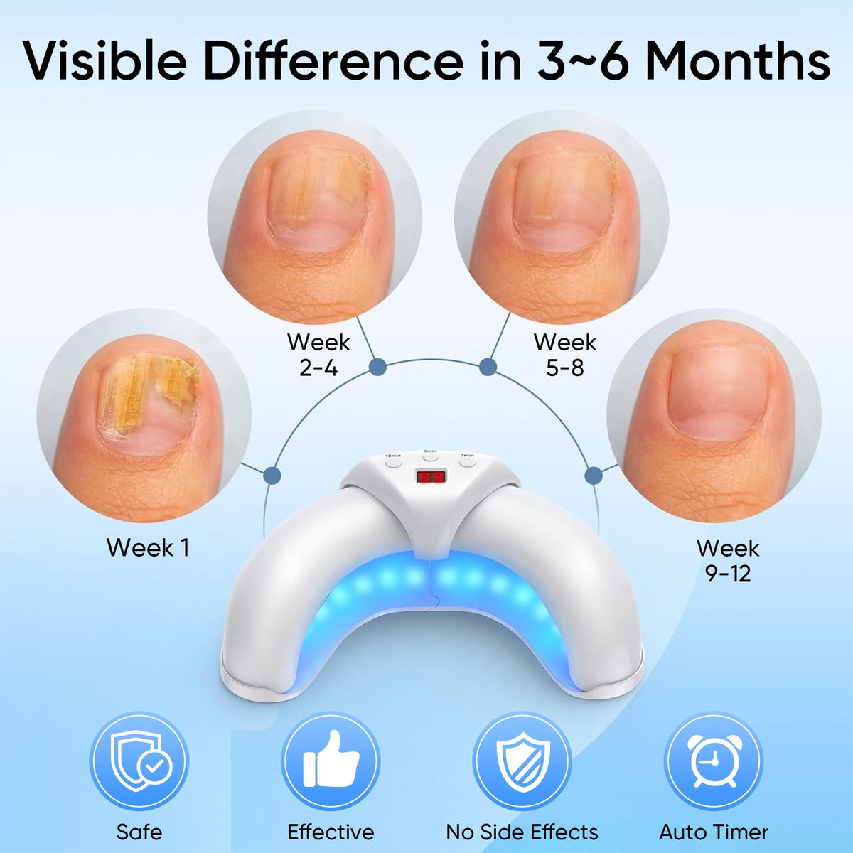 PANIMOSI bi-daily 10-minute session promotes consistent conditioning across nails.