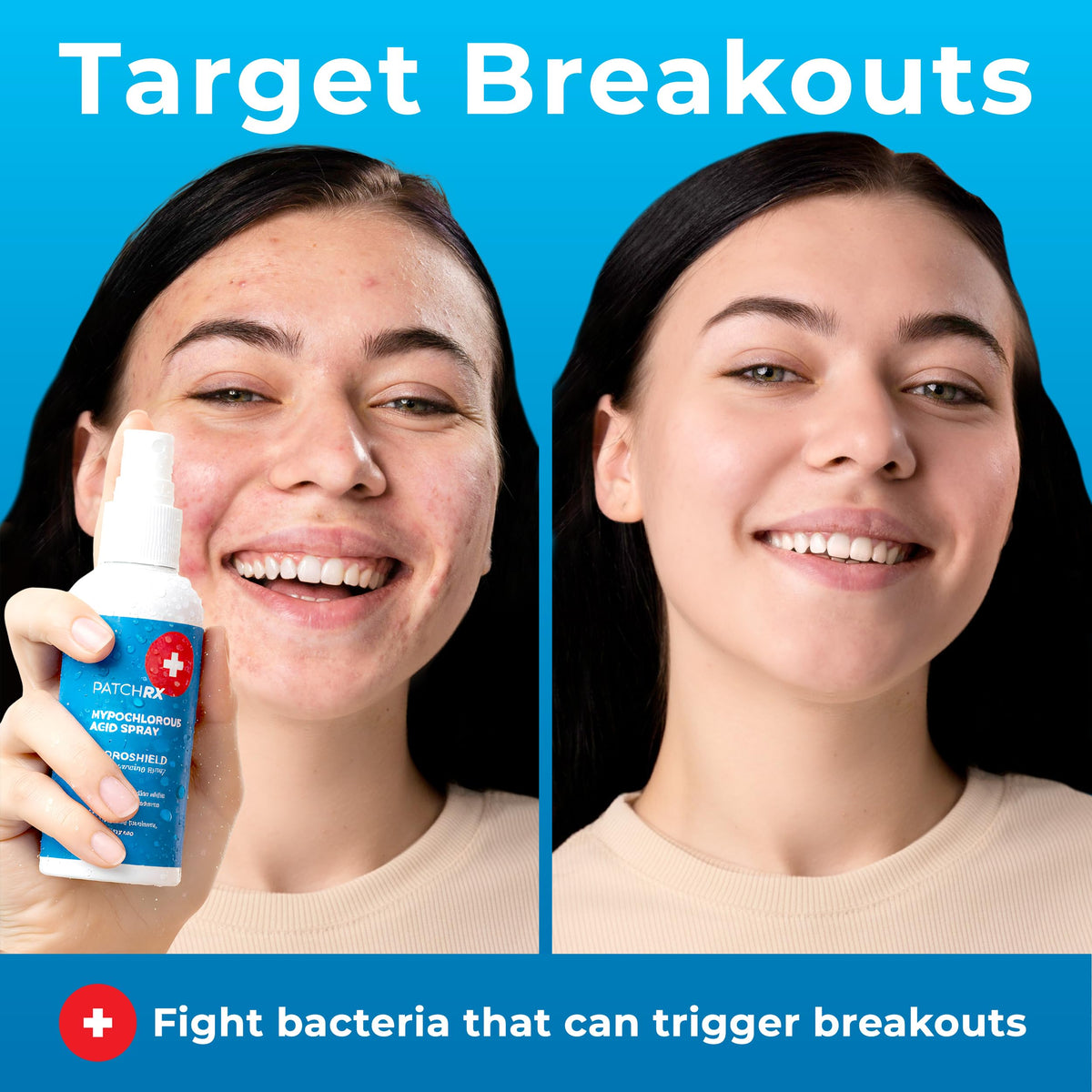 PatchRx HOCl spray two-pack front view highlighting value and convenience