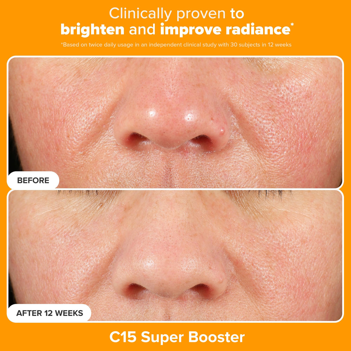 Paula's Choice C15 Booster serum highlighting antioxidant support for even tone