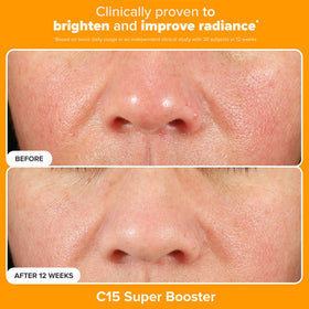 Paula's Choice C15 Booster serum highlighting antioxidant support for even tone