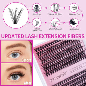 PAVONNE application tweezers for precise sectioning and placement.
