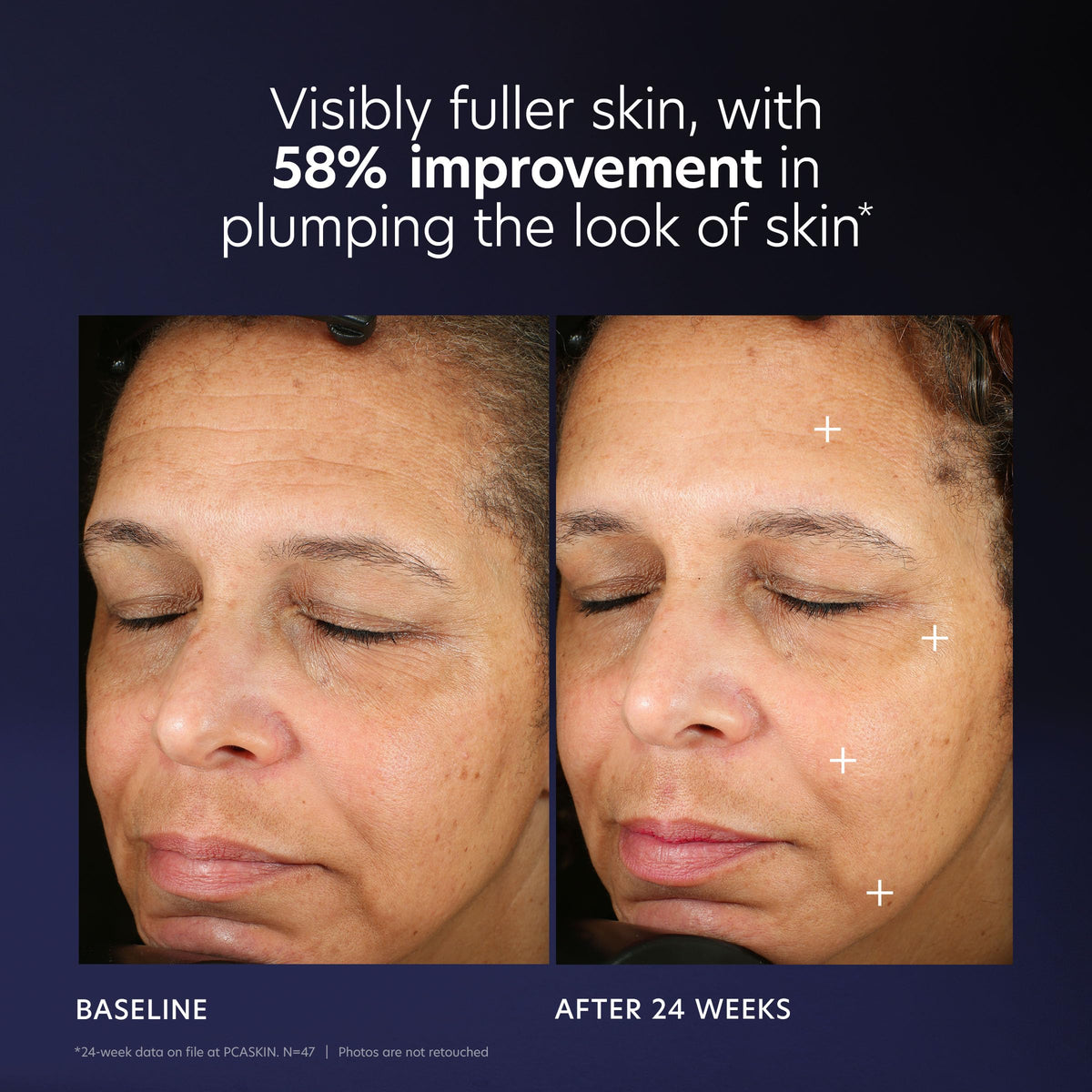 Packaging detail highlighting the pump design of PCA SKIN Pro Max Age Renewal.