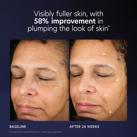 Packaging detail highlighting the pump design of PCA SKIN Pro Max Age Renewal.