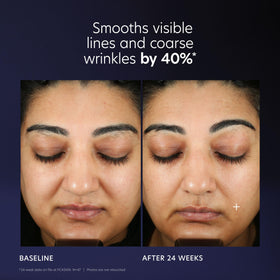 Glowing skin close-up after using PCA SKIN Pro Max Age Renewal.
