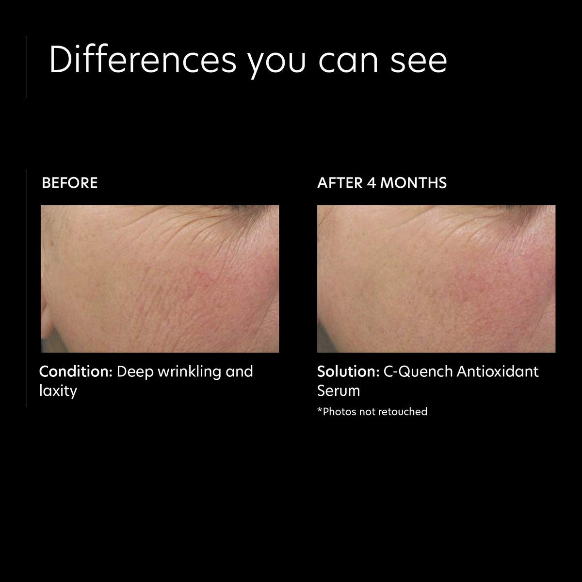 PCA Skin Vitamin C Quench serum drop on hand demonstrates hydration-ready texture.