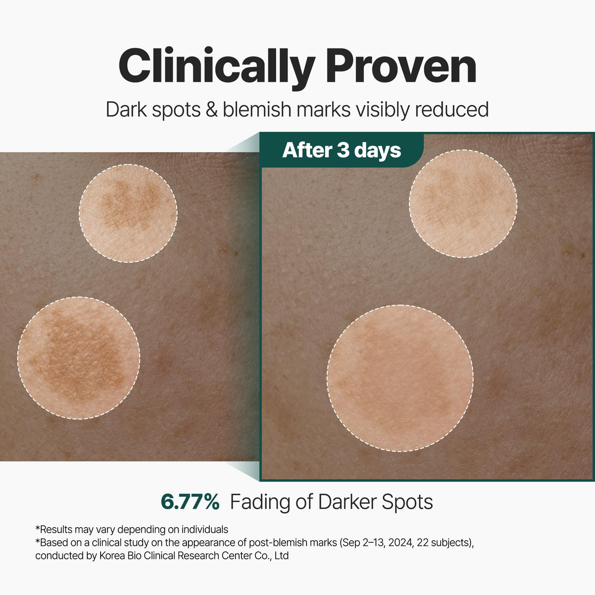 Ingredient focus on CicaLacto Exosome in P.CALM CicaLacto Exosome 45