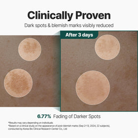 Ingredient focus on CicaLacto Exosome in P.CALM CicaLacto Exosome 45