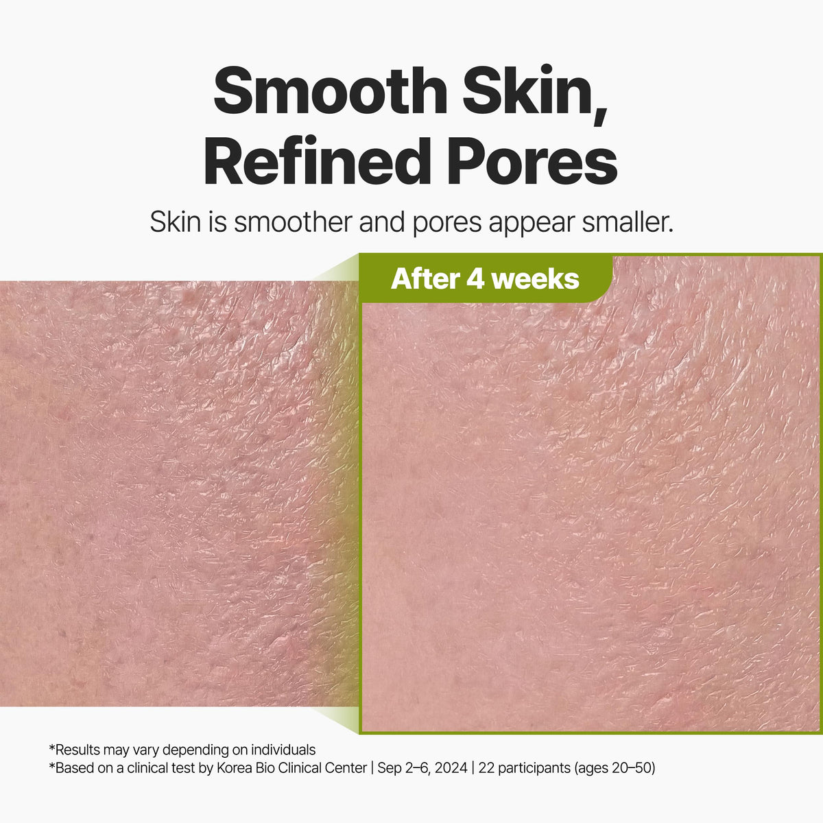P.CALM Bubble Deep Mask with carbonated water delivers a refreshing sensation.