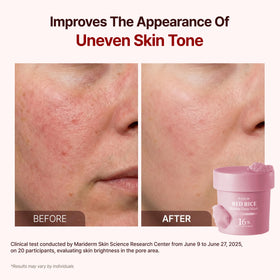 P.CALM Red Rice Bubble Deep Mask carbonated foam on skin during application.
