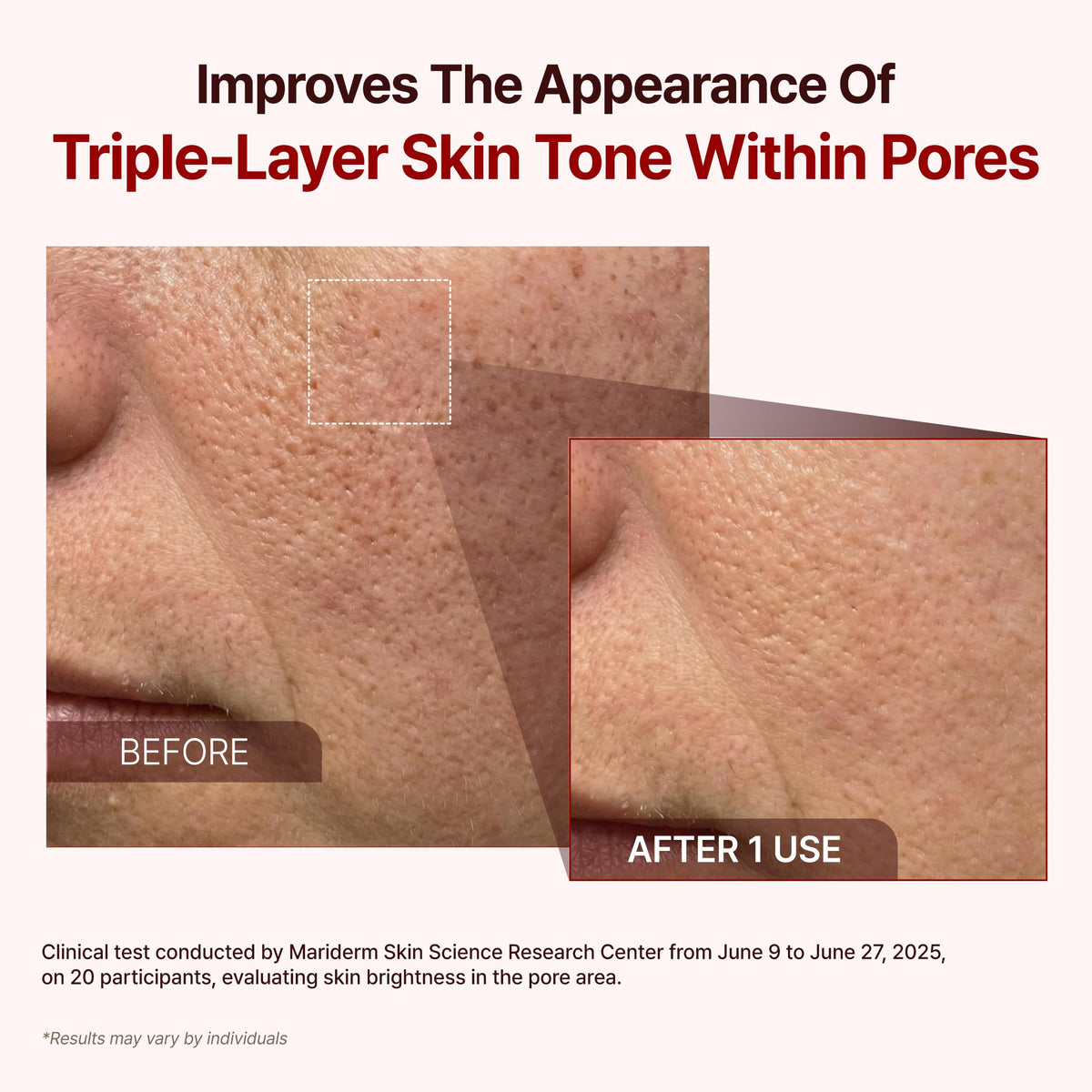 P.CALM Red Rice Bubble Deep Mask rinse-off revealing fresh, balanced skin.