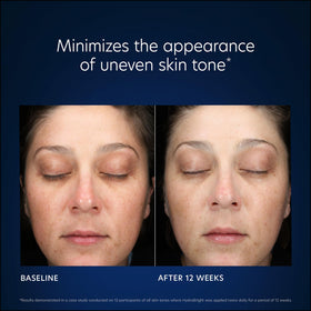 PCA SKIN Biostable Gallic Acid icon signals brightening support.