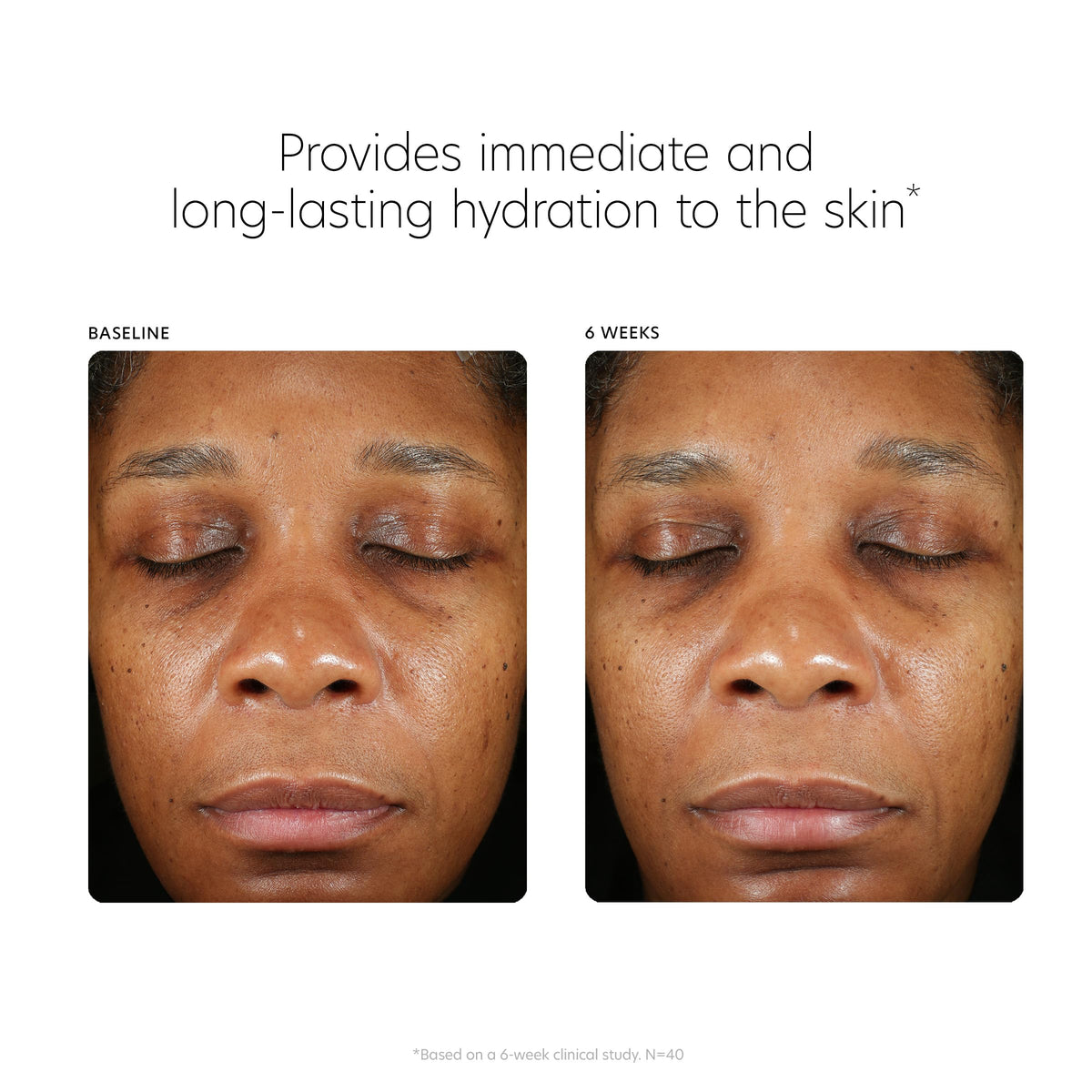 Premium PCA SKIN packaging box emphasizing paraben-free formula