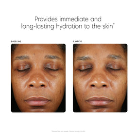 Premium PCA SKIN packaging box emphasizing paraben-free formula