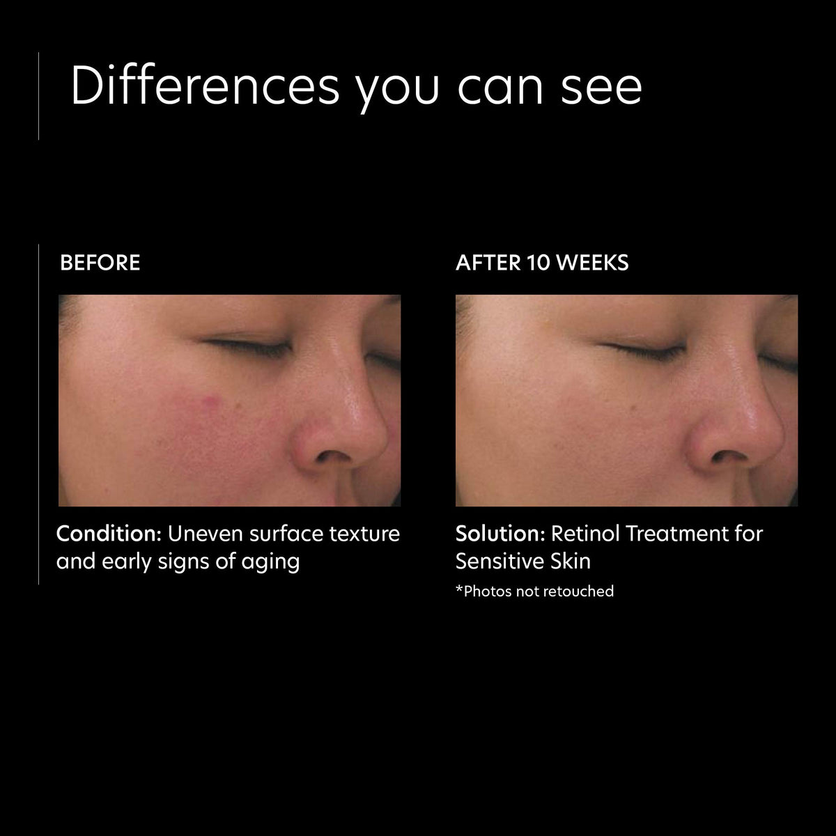 PCA SKIN Retinol Treatment dropper releasing time-release formula