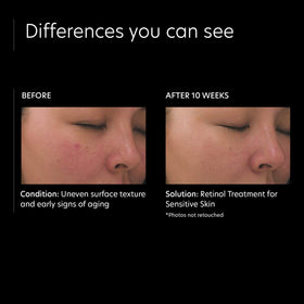 PCA SKIN Retinol Treatment dropper releasing time-release formula
